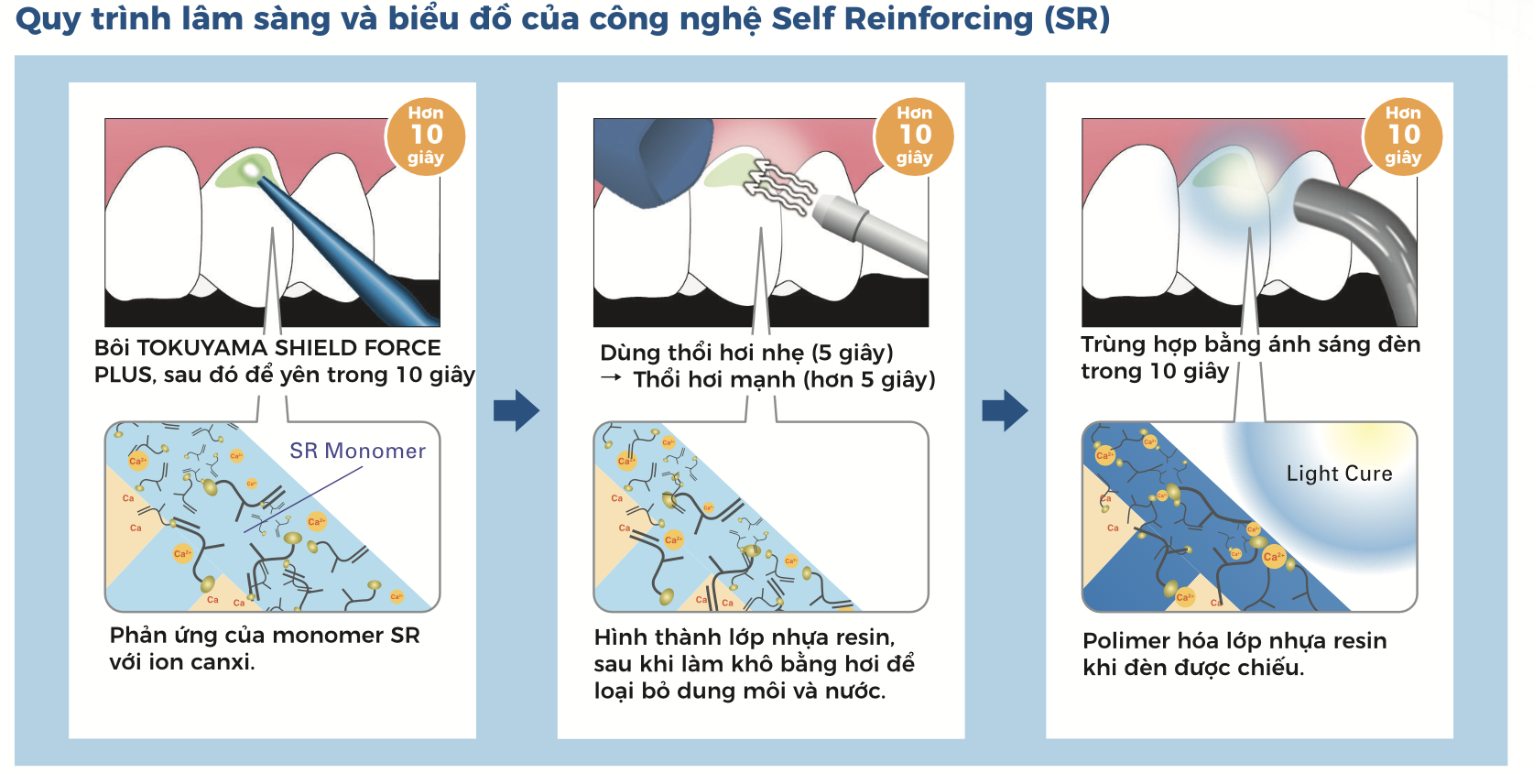 Tokuyama Shield Force Plus🌱Giải pháp hiện đại điều trị ê buốt ngà răng🌱NHA KHOA MALL🌱